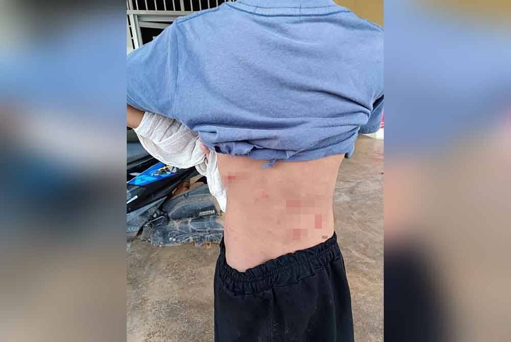 Belakang badan mangsa cedera diserang kera liar