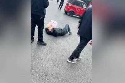 Wanita itu mengalami patah tulang selangka akibat dilanggar lelaki yang rupa-rupanya bakal jodohnya. Foto Agensi