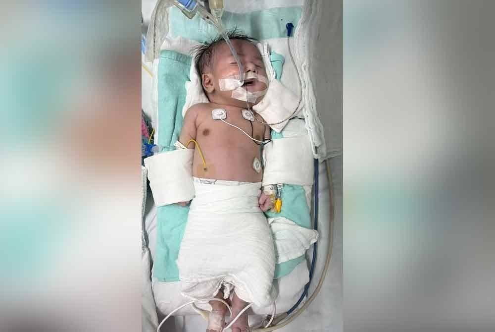 Nur Khadijah yang mengalami masalah jantung sejak dilahirkan.