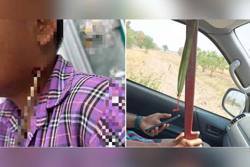 Sebilah anak panah tertusuk di leher seorang budak lelaki di wilayah Nakhon Ratchasima, Thailand. - Agensi