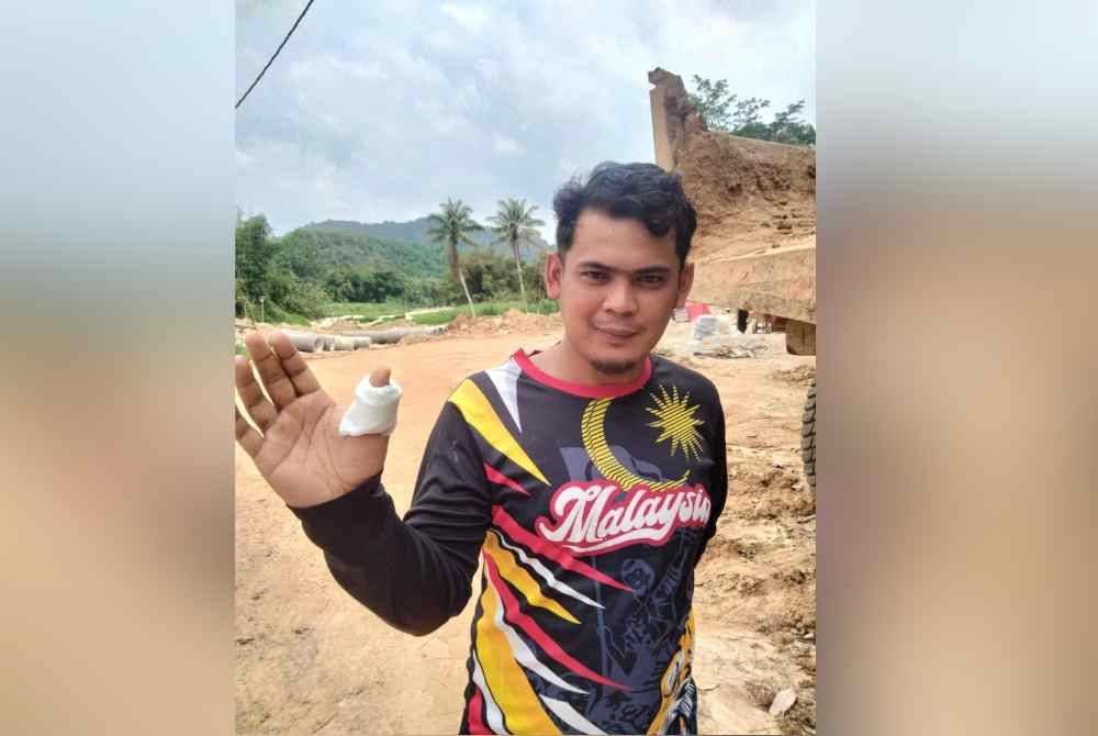 Mohammad Zazli menunjukkan jarinya yang berbalut akibat luka selepas terkena pemegang titi yang patah.