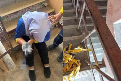 Keadaan tangan seorang murid yang cedera akibat tertusuk besi pemegang tangga berkarat di sebuah sekolah dekat Hulu Kinta.
Foto Media sosial