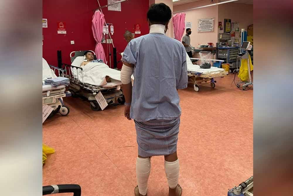 Muhammad Amirul Azhar menunjukkan keadaan bahagian belakang badannya yang melecur akibat kebakaran tersebut.