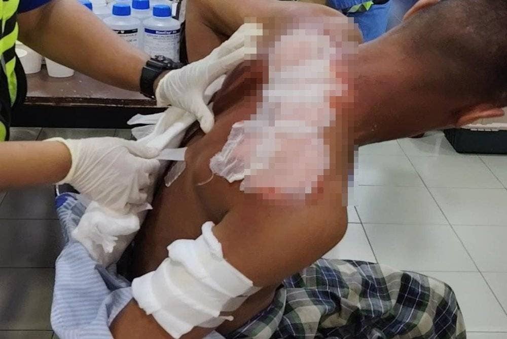 Keadaan bahagian belakang Mohd Yusri setelah mendapatkan rawatan.