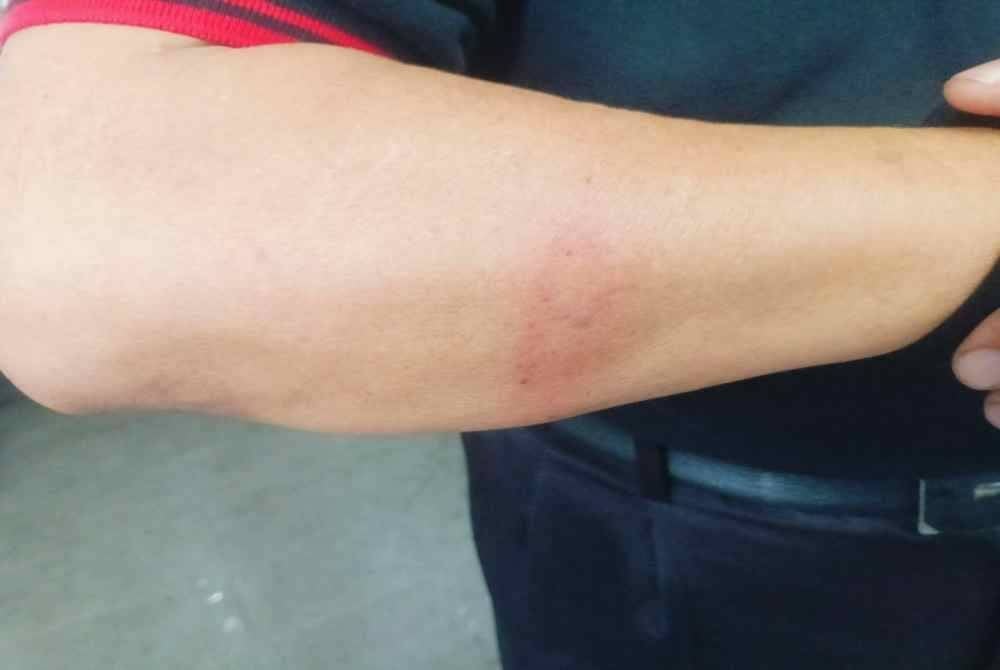 Pemandu bas cedera dipukul dua lelaki.