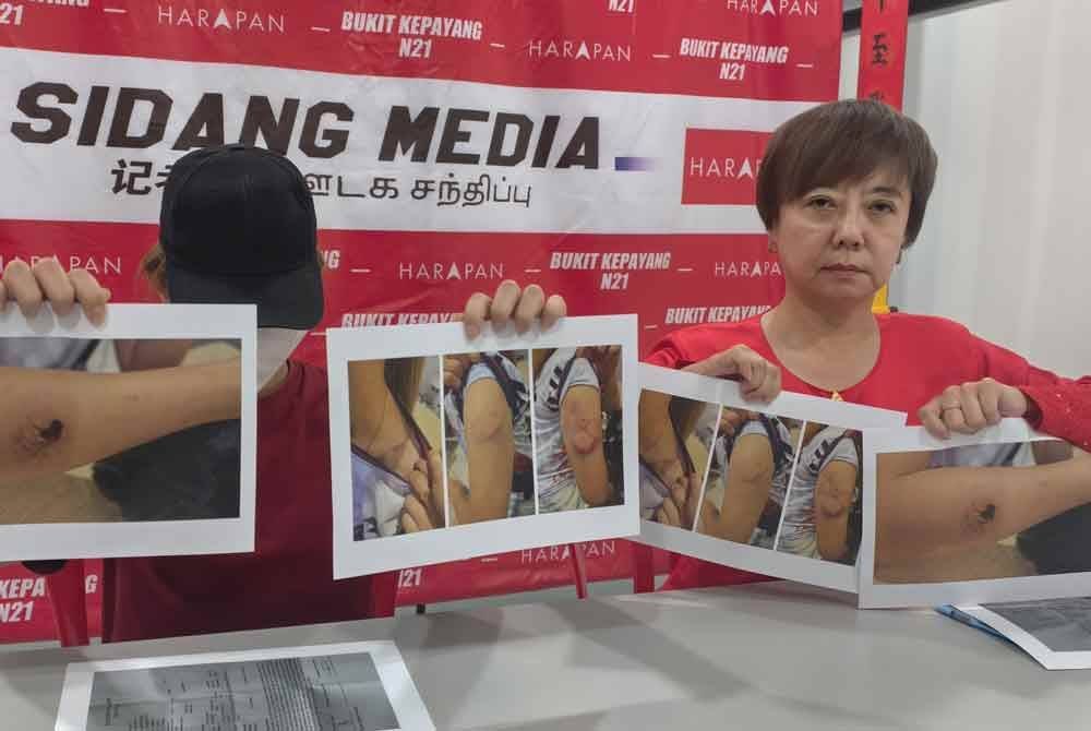 Nicole (kanan) bersama mangsa menunjukkan gambar kecederaan dialami Low selepas dikasari suami.