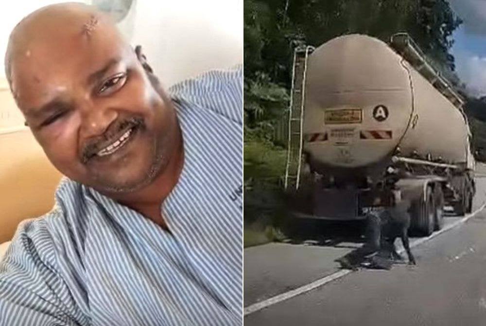 Surej diterkam harimau kumbang ketika berhenti di Bukit Tangga dalam kejadian Khamis lalu menerima lebih 30 jahitan di kepala.