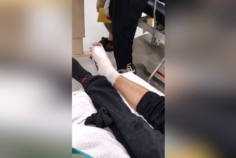 Kaki Mohd Khairi mengalami kecederaan selepas dipukul.