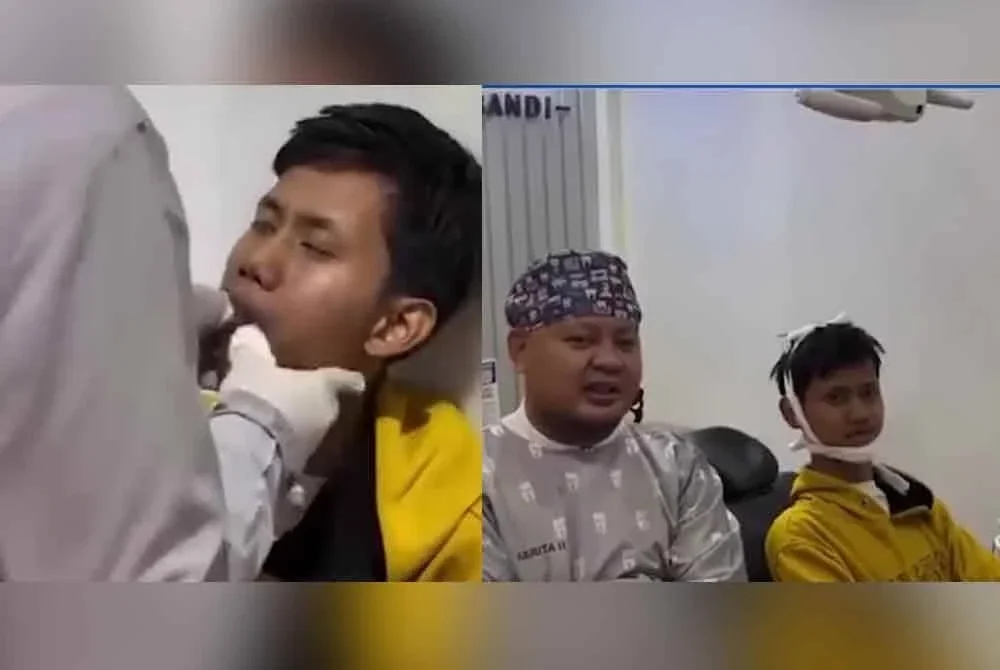 Doktor yang merawat mengesahkan bahawa pesakit mengalami masalah dislokasi rahang, iaitu satu keadaan di mana sendi rahang tergelincir dari kedudukan asal akibat tekanan yang terlalu kuat semasa menguap. - Foto: Agensi