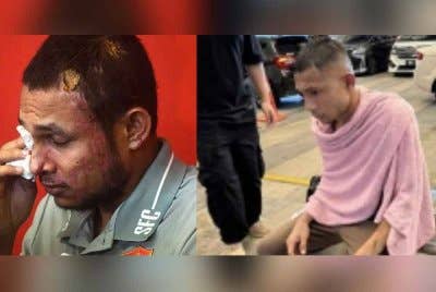 Faisal disimbah asid pada 5 Mei tahun lalu.