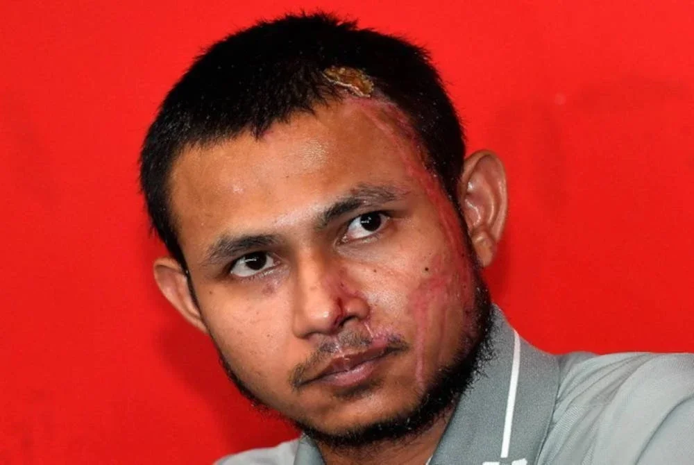 Faisal mahu memandang ke depan dan memajukan kariernya walaupun perasaannya bercampur-baur berhubung siasatan terhadap kesnya disimbah asid.