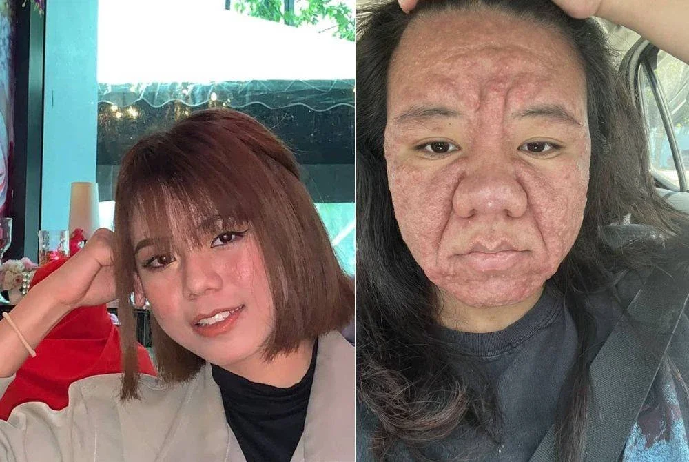 Ayyitslala menunjukkan gambar terkini wajahnya yang berubah ketika hamil.