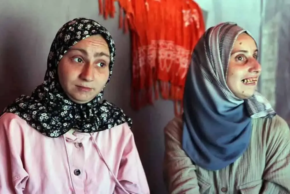 Aseel (kiri) dan Afaf yang mengalami kecacatan serta penyakit seliak, duduk di dalam khemah keluarga mereka di utara Gaza. Foto Noor Al-Halabi/Al Jazeera