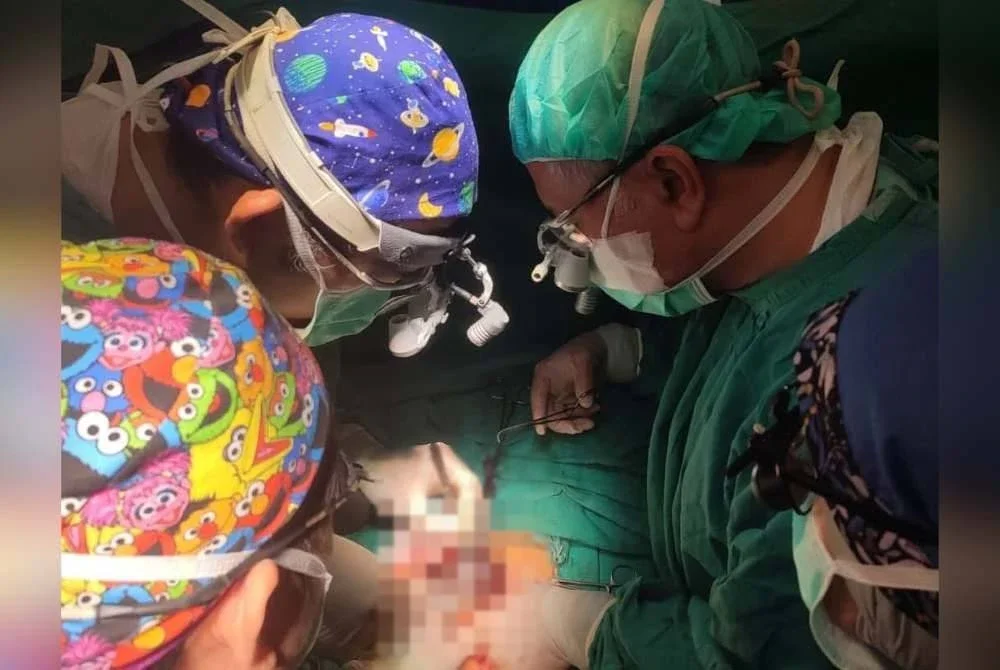 Pembedahan pemisahan sepasang bayi kembar lelaki berusia tiga bulan yang dijalankan di HTA Kuala Lumpur pada 24 Jun lalu.