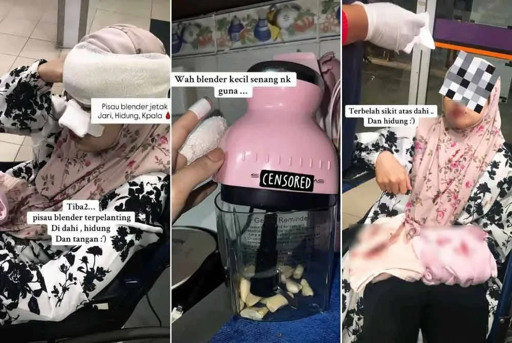 Tangkap layar video menerusi perkongsian di TikTok milik Wan Nur Aisyah menunjukkan keadaannya selepas terkena mata pisau pengisar mudah alih.