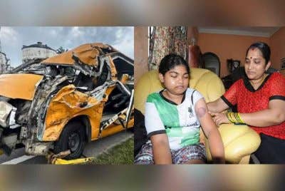 Kartthiyani menunjukkan tangan anaknya yang lebam akibat kemalangan van sekolah tersebut.