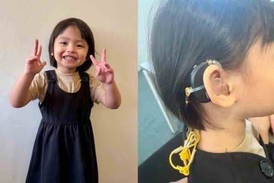 Alat bantuan pendengaran yang dipakai Fatin Nurul Hanis sejak berusia setahun enam bulan.