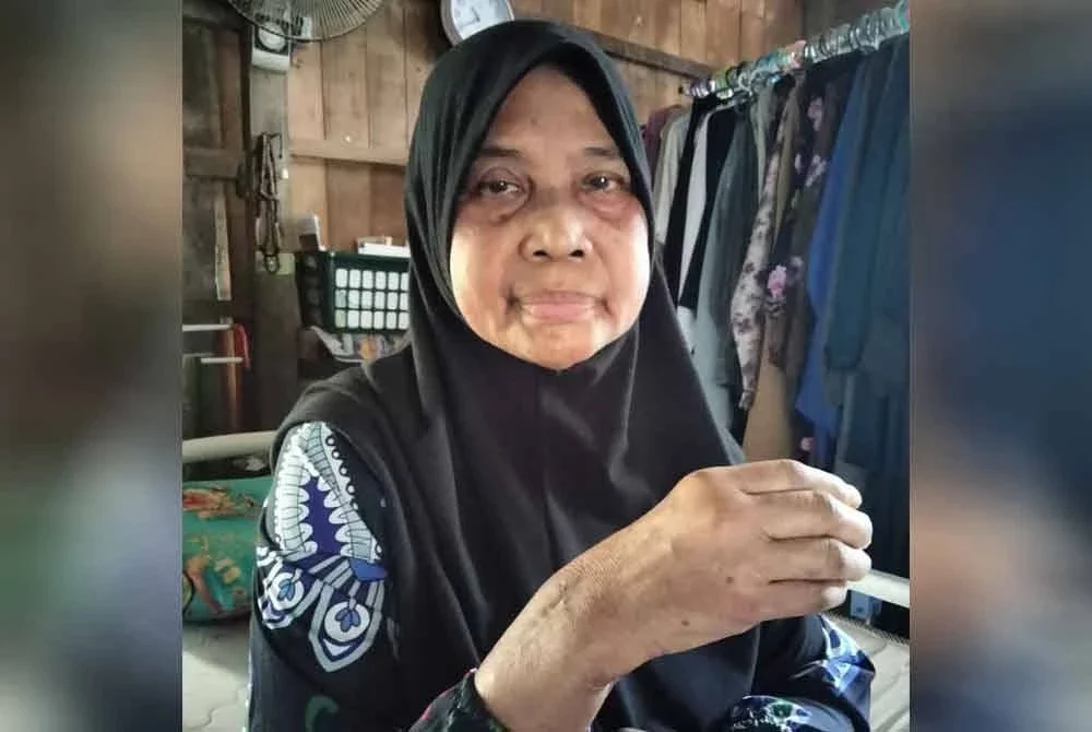 Zainab menunjukkan tangan kanannya yang sebelum ini parah diserang gajah.