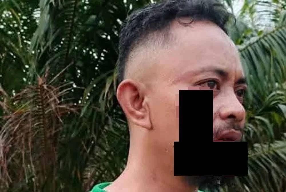 Abdul Halim cedera selepas motosikal yang ditungganginya dilanggar seekor anjing liar yang meluru melintas di Jalan Kampung Orang Asli Batu Peti, Rompin pada Rabu. Foto: Facebook ADUN Jeram Padang
