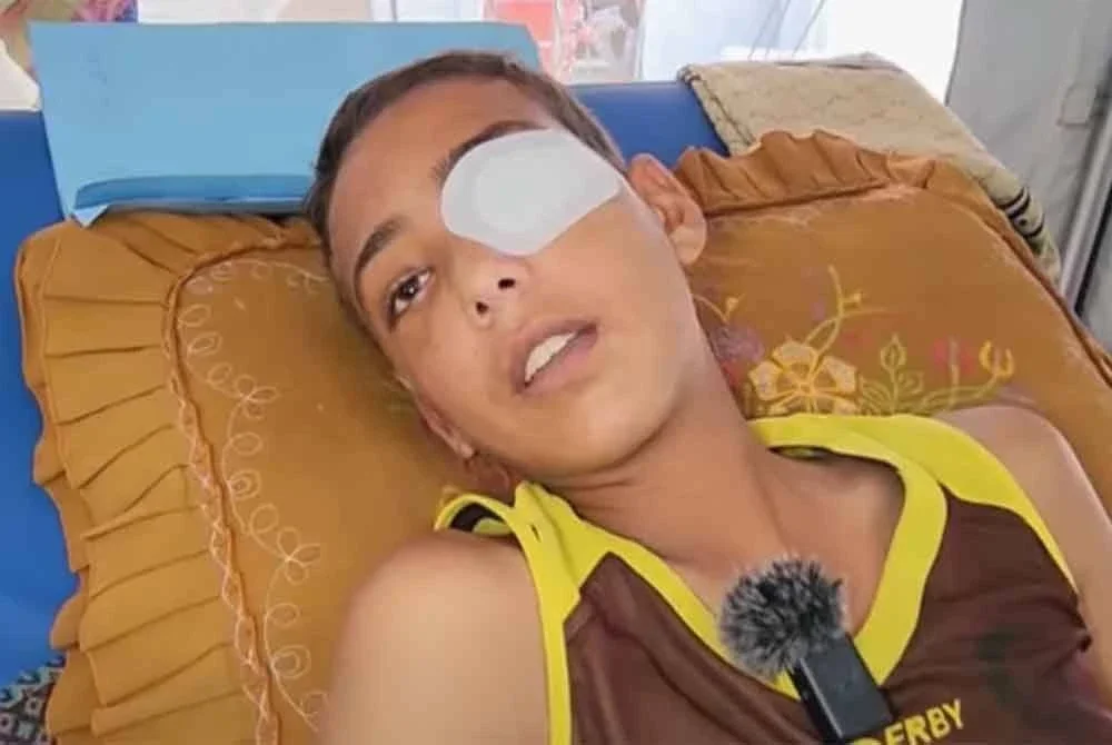 Abu Jazar mungkin kehilangan sebelah matanya akibat serangan tembakan tersebut.