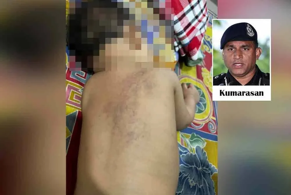 Hantaran tular di Facebook memaparkan gambar kesan kecederaan menyerupai parut pada bahagian belakang badan kanak-kanak terbabit, yang didakwa dialami selepas dibawa pulang dari pusat jagaan pada 17 Januari.