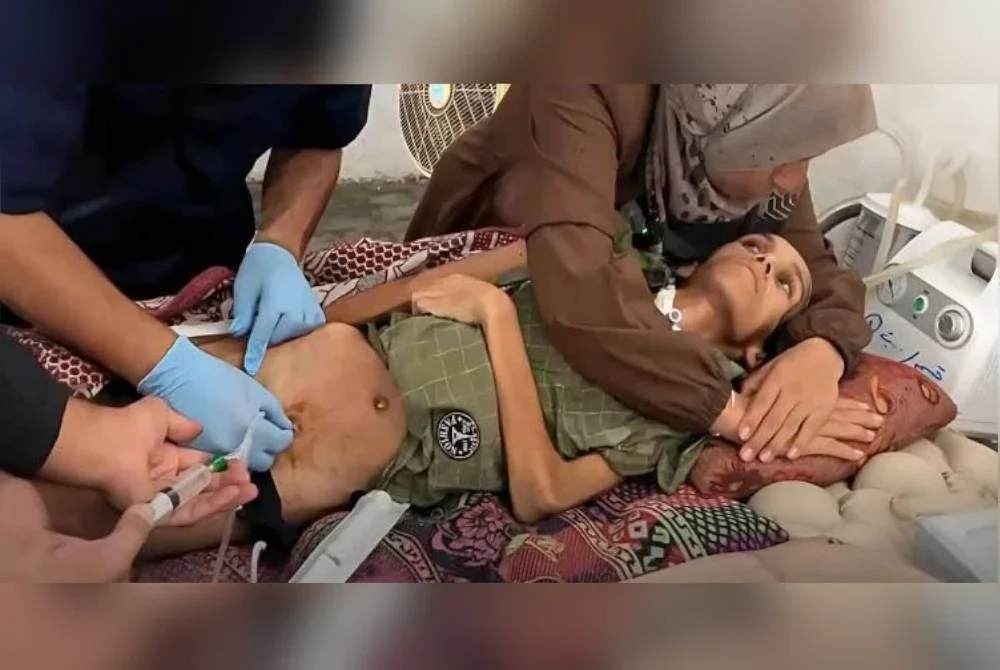 Serangan penyakit bermula dengan kehilangan pergerakan otot secara tiba-tiba yang biasanya bermula daripada kaki sebelum merebak ke bahagian atas tubuh. Foto Agensi