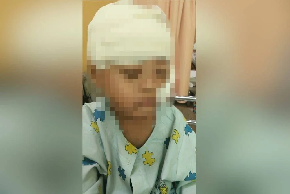 Mangsa baru selesai menjalani pembedahan pada bahagian kepala.