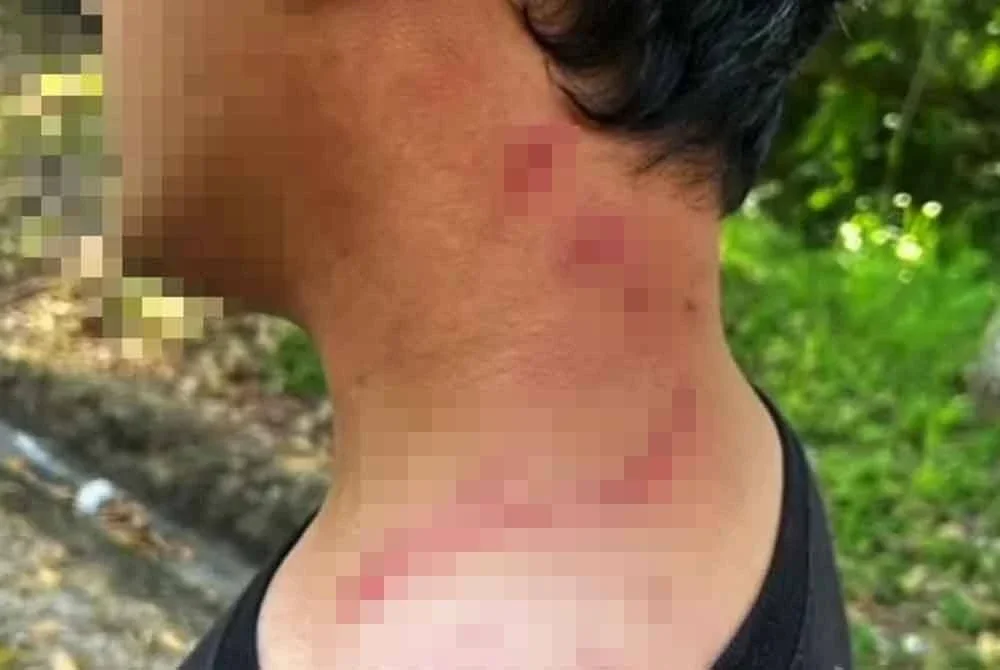 Tangkap layar menerusi klip video tular memaparkan kecederaan di leher mangsa akibat serangan suspek berusia 24 tahun.