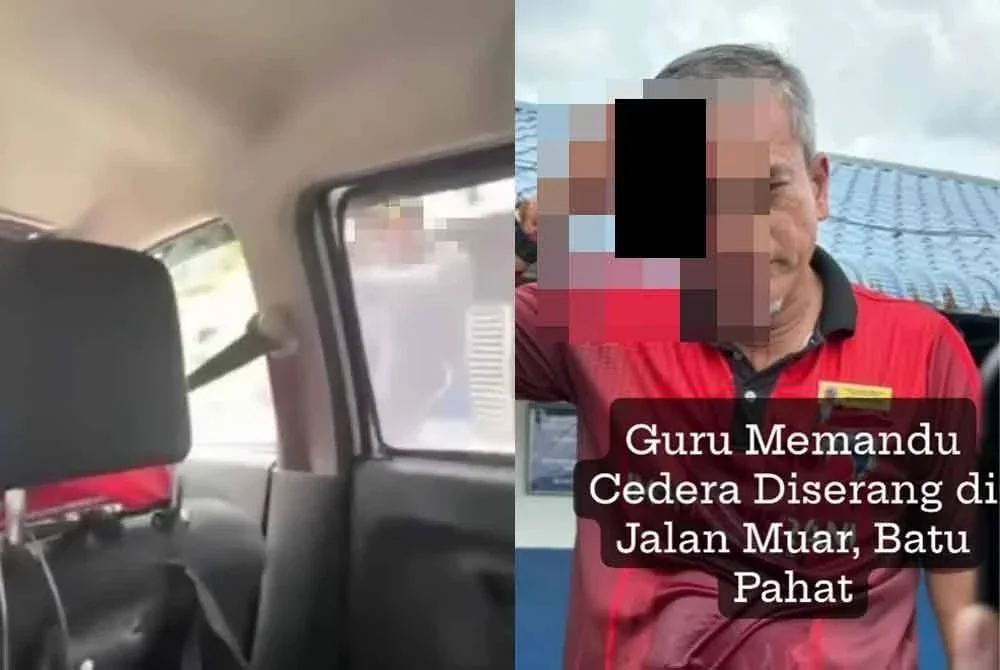 Tangkap layar tular menunjukkan keadaan guru memandu yang cedera selepas dipercayai ditumbuk suspek.