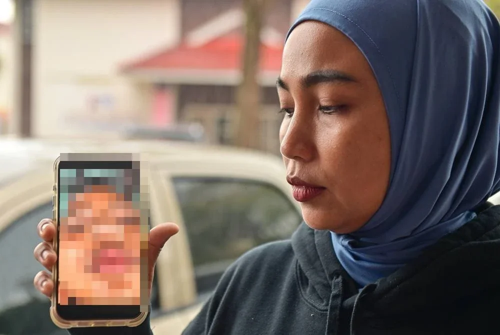  Seorang murid lelaki Tahun Dua di sebuah sekolah di daerah ini patah tulang hidung dan retak tulang mata selepas didakwa dipukul beberapa rakan sekolah dalam kejadian pada 30 Julai lalu.