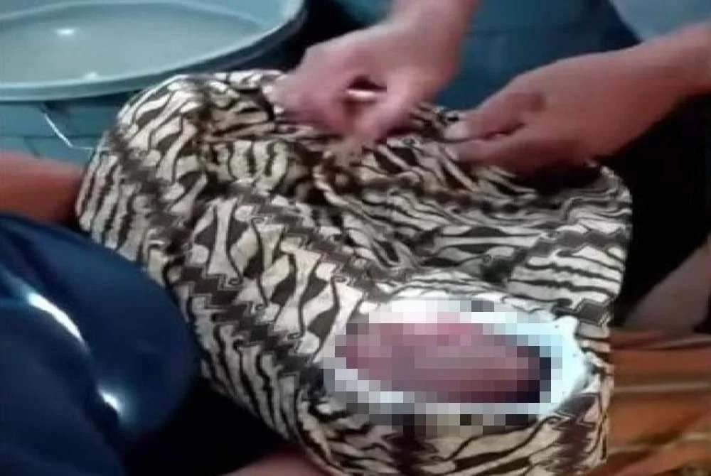 Klip memaparkan keadaan bayi tersebut meraih simpati warganet. Foto Agensi