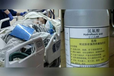 Mangsa dilaporkan maut selepas lima hari di rawat akibat terpijak botol asid. Asid hidrofluorik (kanan).