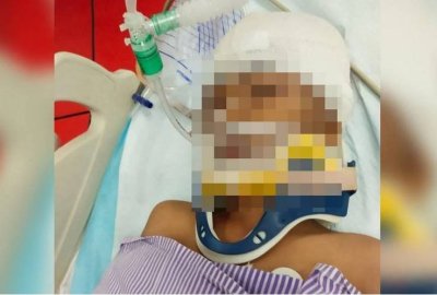 Muhammad Ammar yang mengalami kecederaan parah pada kepala akibat dipukul dengan tukul, kini masih dirawat di ICU Hospital Pakar Universiti Sains Malaysia.