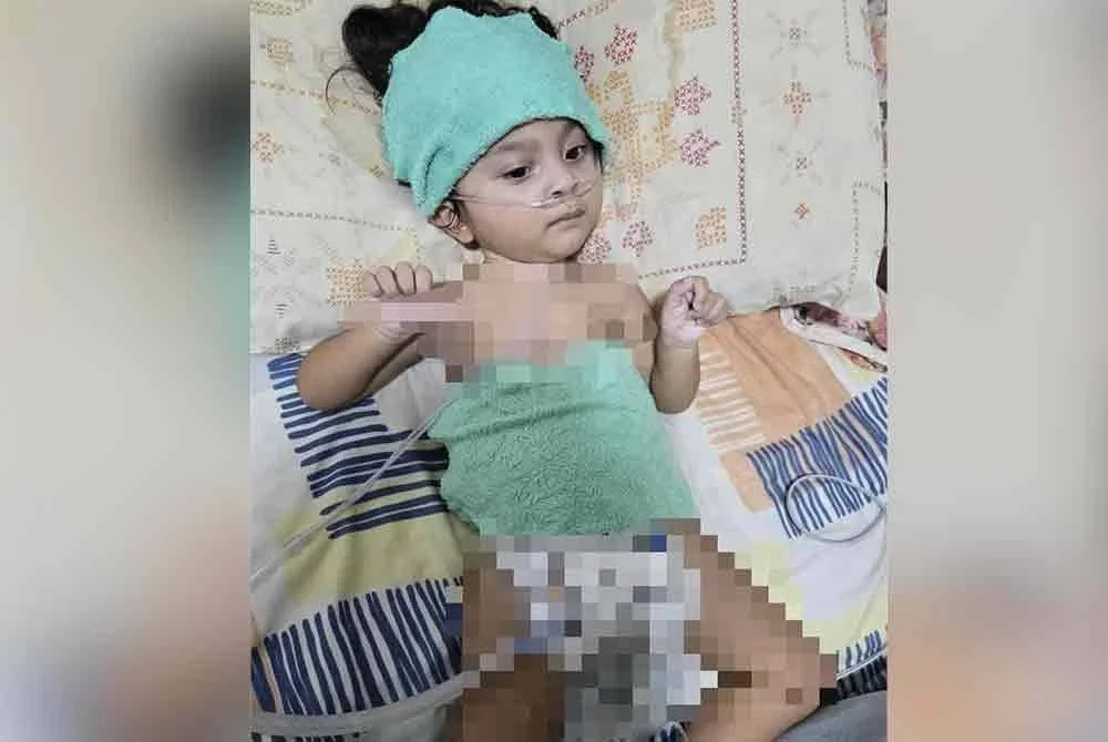 Nur Nadine Mikayla menghidap SMA memerlukan dana RM85,400 untuk menampung kos rawatannya termasuk ubat, rawatan hospital dan fisioterapi.