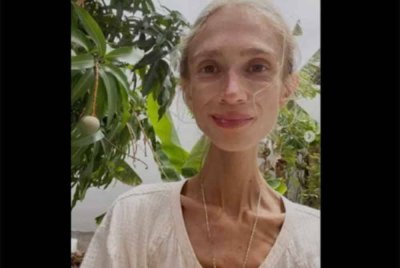 Berat badan mangsa hanya 22 kilogram. Foto Agensi