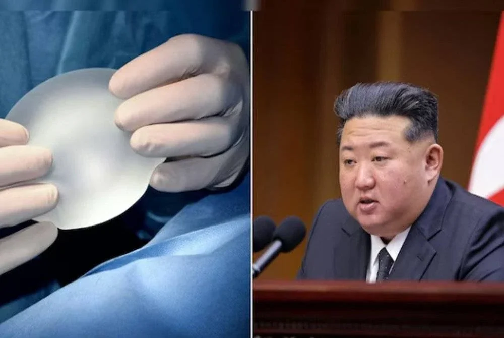Kerajaan pimpinan Kim Jong Un menganggap prosedur kosmetik itu sebagai 'tidak sosialis' dan 'berunsur kapitalis'. Foto Agensi