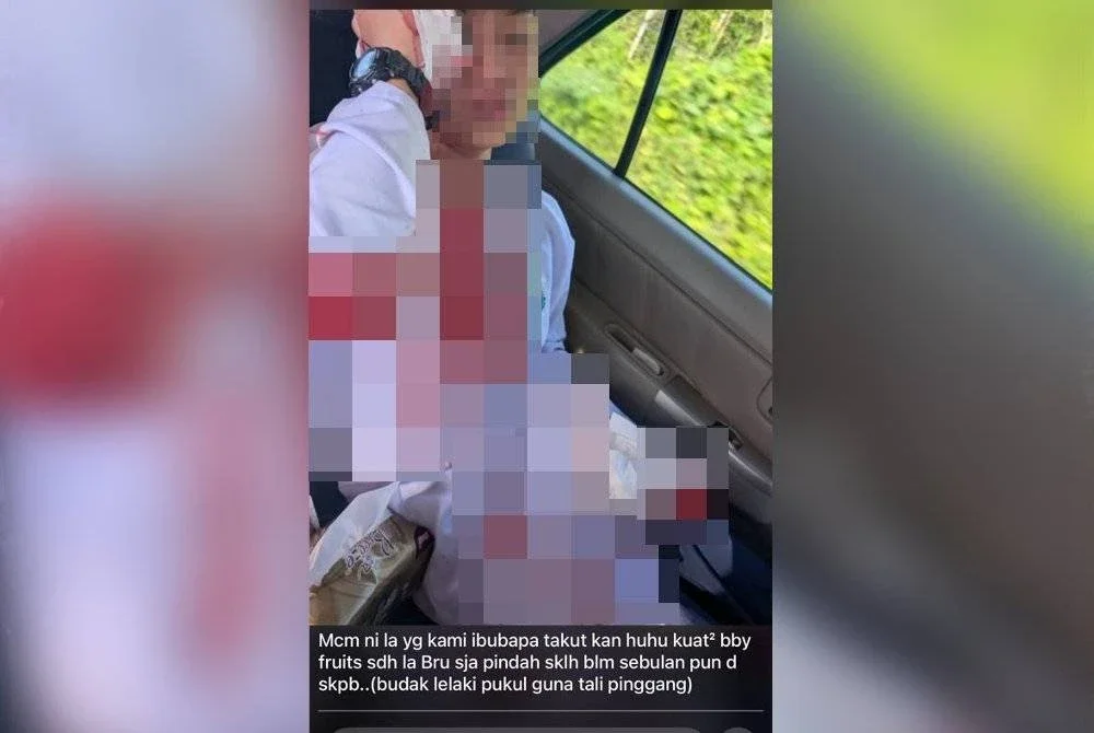 Gambar yang tular memaparkan seorang murid sekolah cedera.