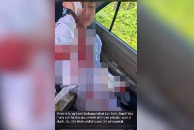 Gambar yang tular memaparkan seorang murid sekolah cedera.