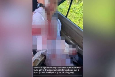 Gambar seorang murid perempuan berlumuran darah yang tular di media sosial.