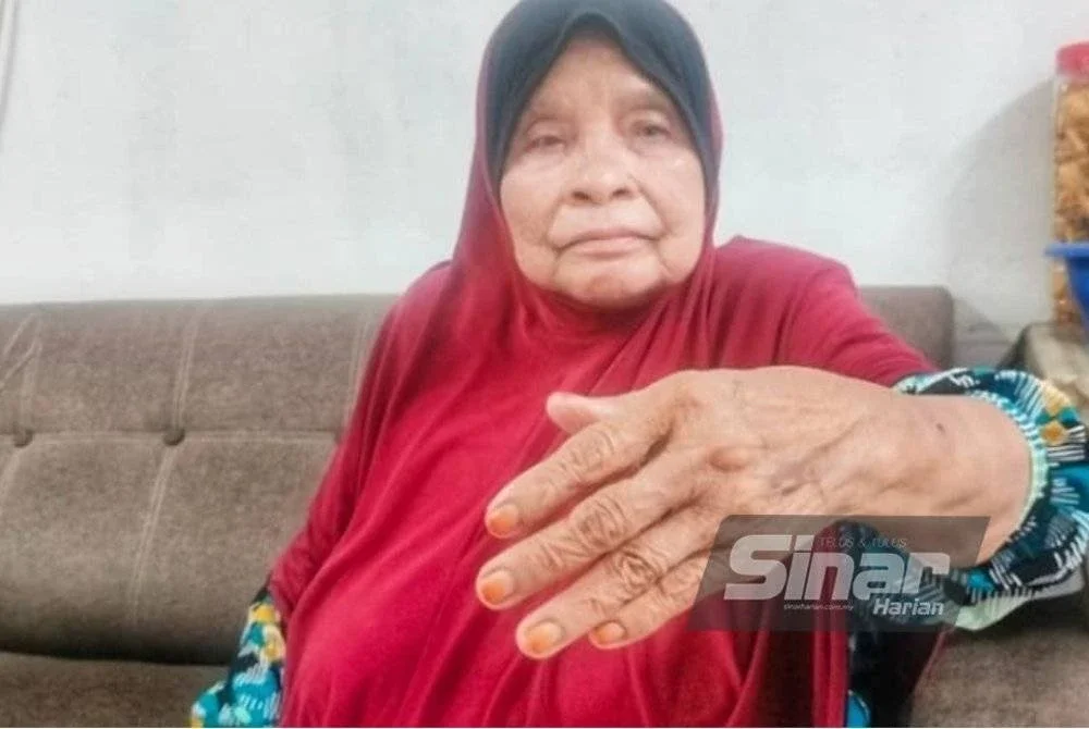 Robiah menunjukkan kecederaan yang dialami.