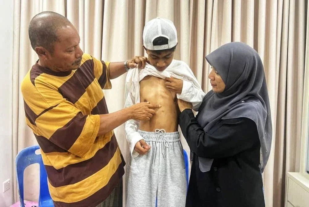 Salehudin dan isterinya, Nor Ezah Abdul Rahman, 52, menunjukkan kesan pembedahan jantung berlubang Mohammad Azim ketika berusia lapan tahun.