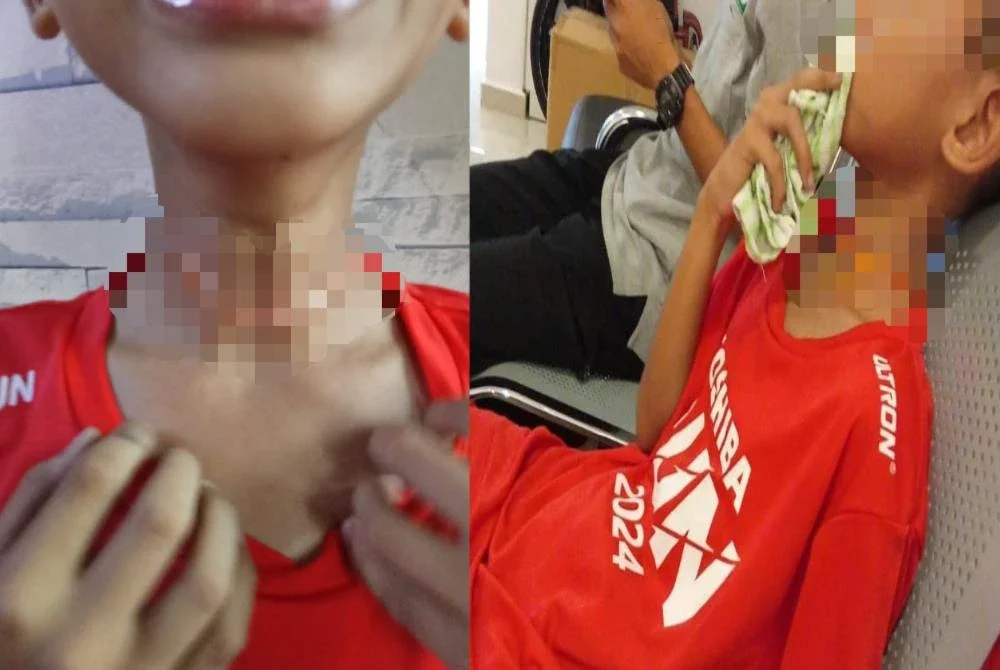 Mangsa mengalami luka di leher dibawa ke klinik sebelum dirujuk ke HTAR Klang.