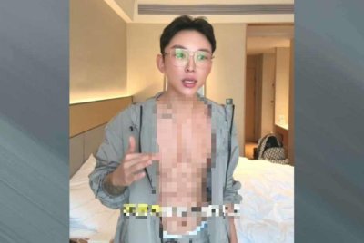 Hao menunjukkan perut berotot selepas menyuntik dengan cecair asid hialuronik. - Agensi