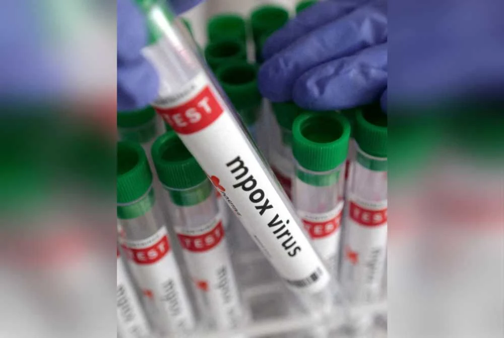 KKM mengesahkan berlakunya satu kluster baharu mpox membabitkan empat sekeluarga. Foto hiasan