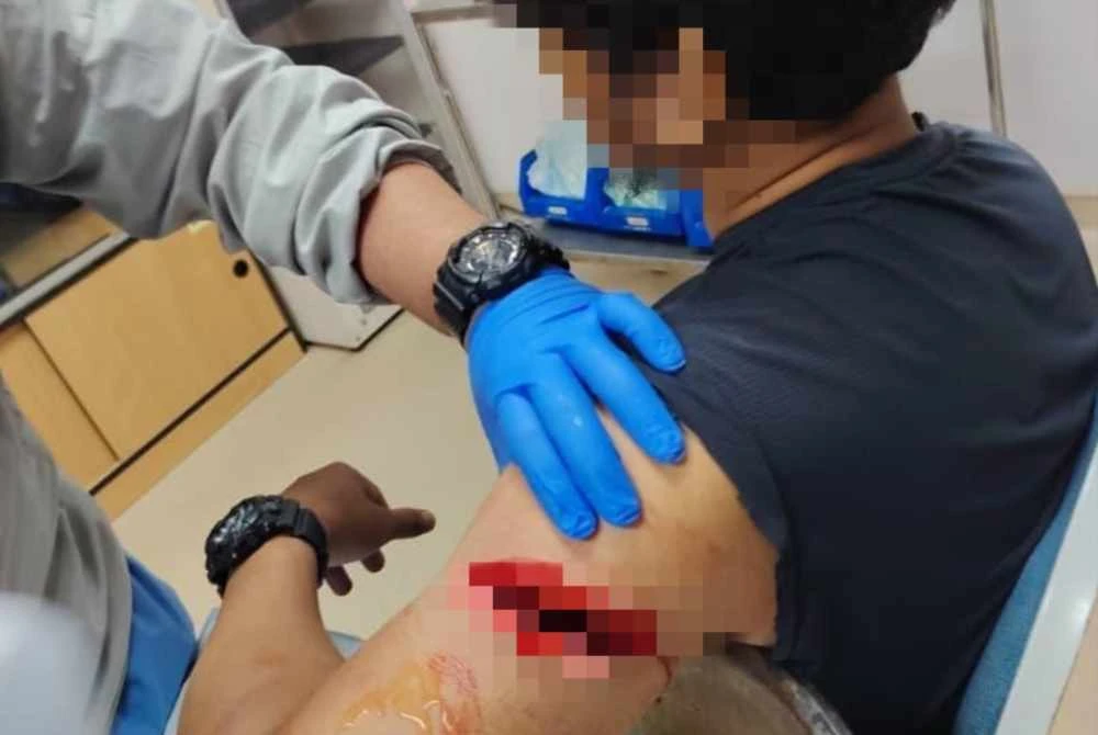 Seorang anggota polis berpangkat koperal berusia 30-an cedera parah di lengan kiri selepas dilibas parang oleh suspek.