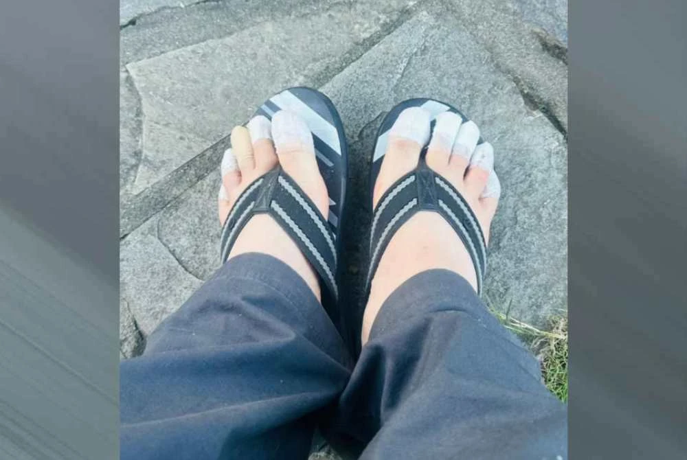 Kesemua jari kaki saya berbungkus.