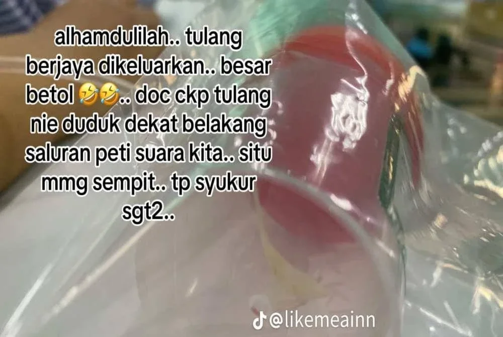 Tulang ikan terlekat dalam saluran peti suara Nur Ainzahidah