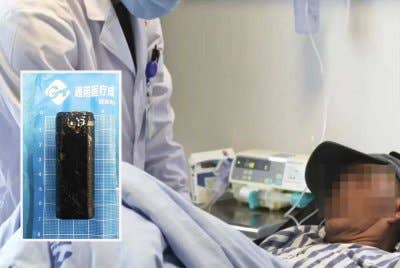 Deng mula mengalami masalah kesihatan selepas menelan pemetik api (gambar kecil) kira-kira tiga dekad lalu. Foto Agensi