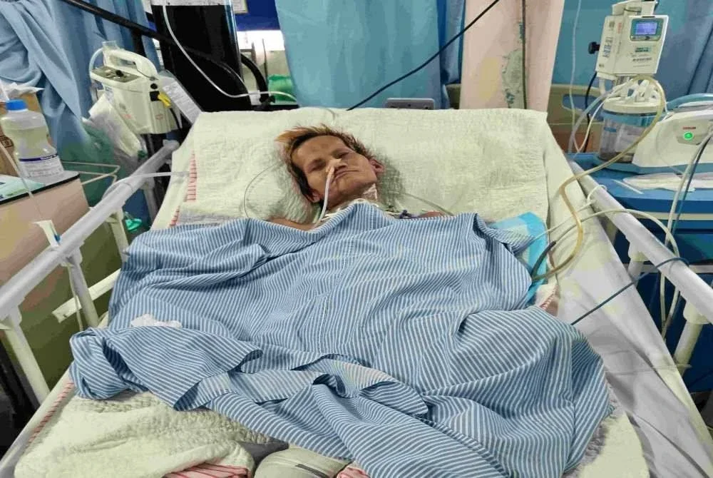 Kong Weng masih dirawat di Hospital Taiping selepas terbabit kemalangan pada 14 September lalu.