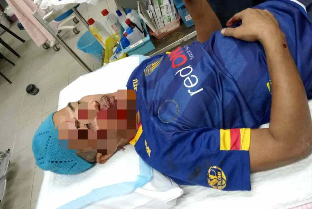 Seorang pengawal keselamatan terpaksa menerima tujuh jahitan selepas motosikal yang ditungganginya terlanggar seekor lembu berkeliaran dalam kejadian di Gong Medang, di sini malam Selasa.